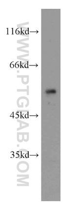 RORB Antibody in Western Blot (WB)