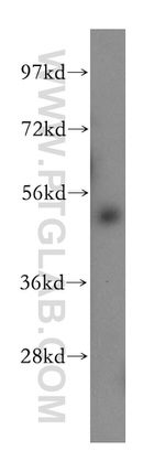 RORB Antibody in Western Blot (WB)