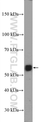 RORB Antibody in Western Blot (WB)
