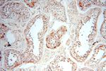PGBD3 Antibody in Immunohistochemistry (Paraffin) (IHC (P))