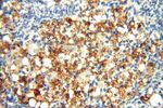 PGBD3 Antibody in Immunohistochemistry (Paraffin) (IHC (P))