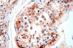 PGBD3 Antibody in Immunohistochemistry (Paraffin) (IHC (P))