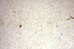 PGBD3 Antibody in Immunohistochemistry (Paraffin) (IHC (P))