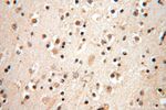 PGBD3 Antibody in Immunohistochemistry (Paraffin) (IHC (P))