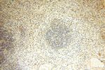 PGBD3 Antibody in Immunohistochemistry (Paraffin) (IHC (P))