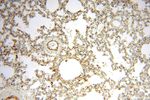 PGBD3 Antibody in Immunohistochemistry (Paraffin) (IHC (P))