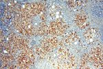 PGBD3 Antibody in Immunohistochemistry (Paraffin) (IHC (P))