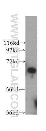 PGBD3 Antibody in Western Blot (WB)