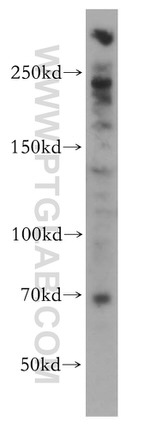 PGBD3 Antibody in Western Blot (WB)