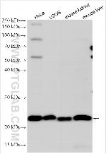 SPCS3 Antibody in Western Blot (WB)