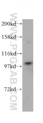 C7 Antibody in Western Blot (WB)