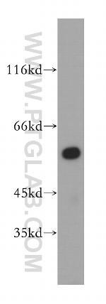 HMGCS1 Antibody in Western Blot (WB)
