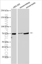 SLC26A7 Antibody in Western Blot (WB)