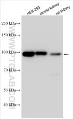 SLC26A7 Antibody in Western Blot (WB)