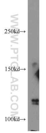 RANBP6 Antibody in Western Blot (WB)
