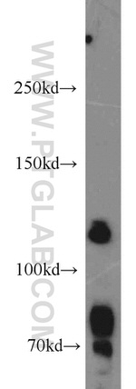 RANBP6 Antibody in Western Blot (WB)