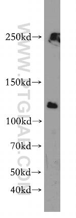 RANBP6 Antibody in Western Blot (WB)