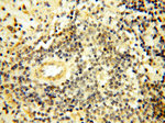 LGR6 Antibody in Immunohistochemistry (Paraffin) (IHC (P))