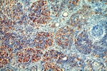 LGR6 Antibody in Immunohistochemistry (Paraffin) (IHC (P))