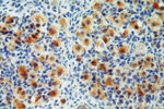 LGR6 Antibody in Immunohistochemistry (Paraffin) (IHC (P))