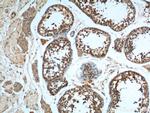 LGR6 Antibody in Immunohistochemistry (Paraffin) (IHC (P))