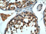 LGR6 Antibody in Immunohistochemistry (Paraffin) (IHC (P))