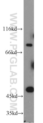 LGR6 Antibody in Western Blot (WB)
