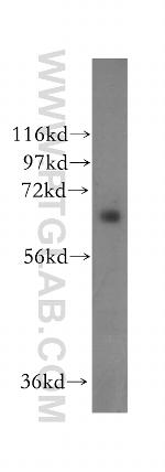 SENP3 Antibody in Western Blot (WB)