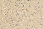 CPNE2 Antibody in Immunohistochemistry (Paraffin) (IHC (P))