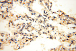 TYW1B Antibody in Immunohistochemistry (Paraffin) (IHC (P))