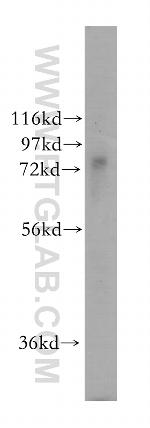 TYW1B Antibody in Western Blot (WB)