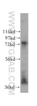 TYW1B Antibody in Western Blot (WB)