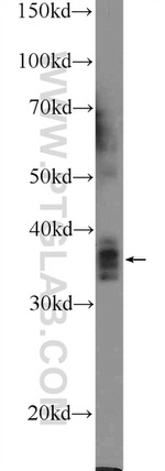 HNRNPH3 Antibody in Western Blot (WB)