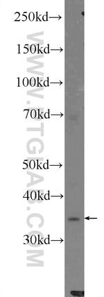 HNRNPH3 Antibody in Western Blot (WB)