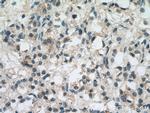 AHNAK2 Antibody in Immunohistochemistry (Paraffin) (IHC (P))