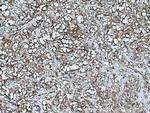 AHNAK2 Antibody in Immunohistochemistry (Paraffin) (IHC (P))