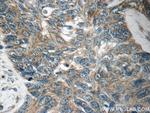 MRPL54 Antibody in Immunohistochemistry (Paraffin) (IHC (P))