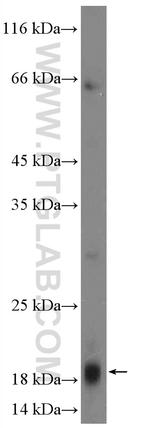 MRPL54 Antibody in Western Blot (WB)