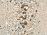 VEZT Antibody in Immunohistochemistry (Paraffin) (IHC (P))