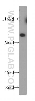 PJA1 Antibody in Western Blot (WB)