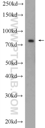 PJA1 Antibody in Western Blot (WB)