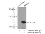 SH3BP4 Antibody in Immunoprecipitation (IP)