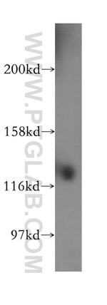 SH3BP4 Antibody in Western Blot (WB)