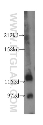 SH3BP4 Antibody in Western Blot (WB)