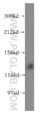 SH3BP4 Antibody in Western Blot (WB)