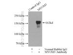 MYOM3 Antibody in Immunoprecipitation (IP)