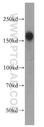 MYOM3 Antibody in Western Blot (WB)