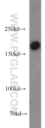 MYOM3 Antibody in Western Blot (WB)
