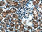 OCRL Antibody in Immunohistochemistry (Paraffin) (IHC (P))