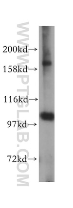 OCRL Antibody in Western Blot (WB)